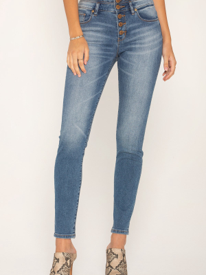 Pinned Up Skinny Jeans