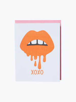 Lips Xoxo Card