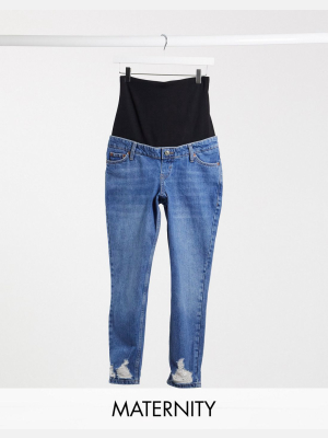 Topshop Maternity Mom Rip Hem Overbump Jeans In Mid Wash