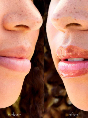 Lovingly Lip™ Lip Treatment Oil